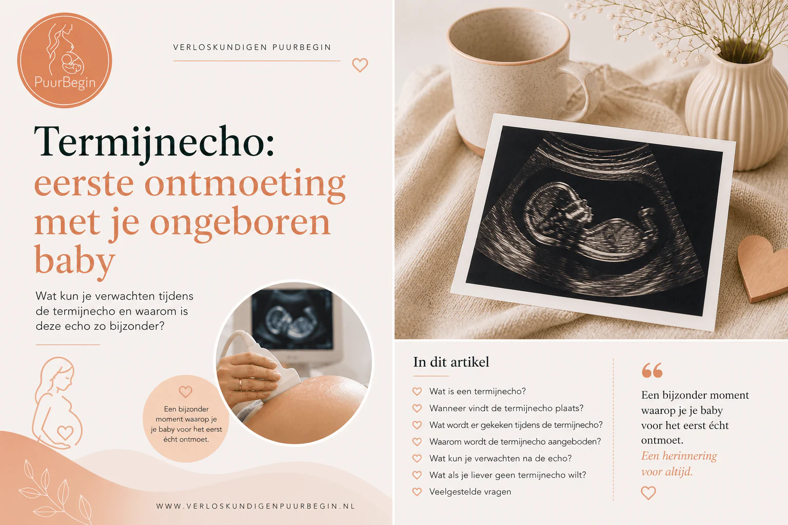 8 heldere punten over de termijnecho: eerste ontmoeting met je ongeboren baby