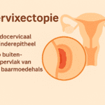 Cervixectopie - Verloskundige Kampen PuurBegin