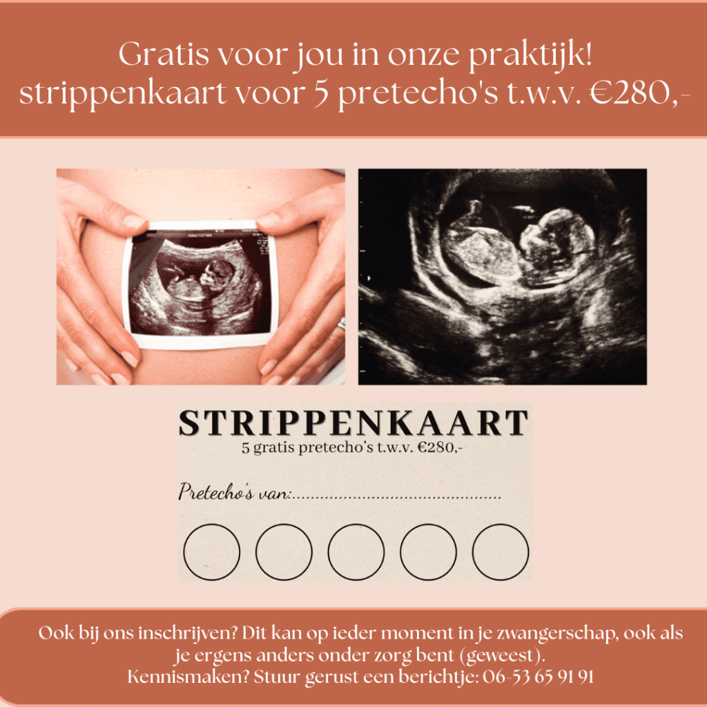 Strippenkaart gratis echo's bij verloskundigen PuurBegin
